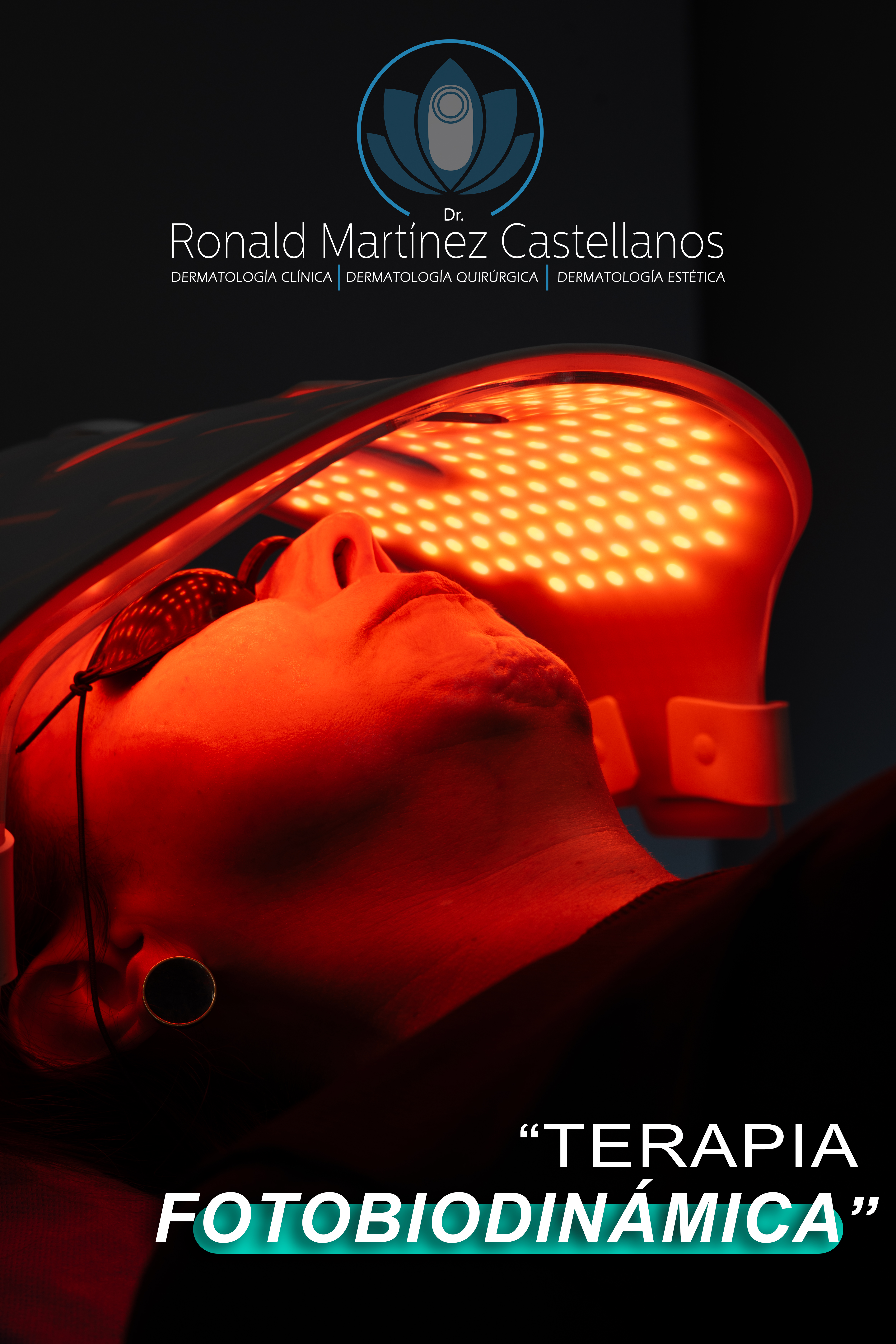 Terapia fotobiodinámica dermatológica